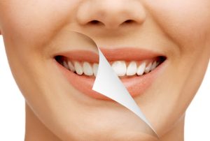 SMILE MAKEOVER