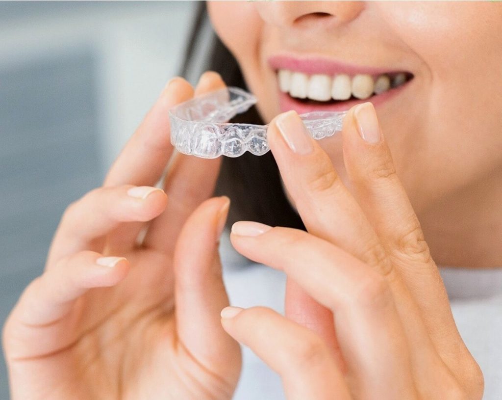 Invisalign clear aligners for adults in Vancouver