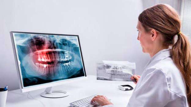 Dentist Looking At Teeth X-ray On Computer