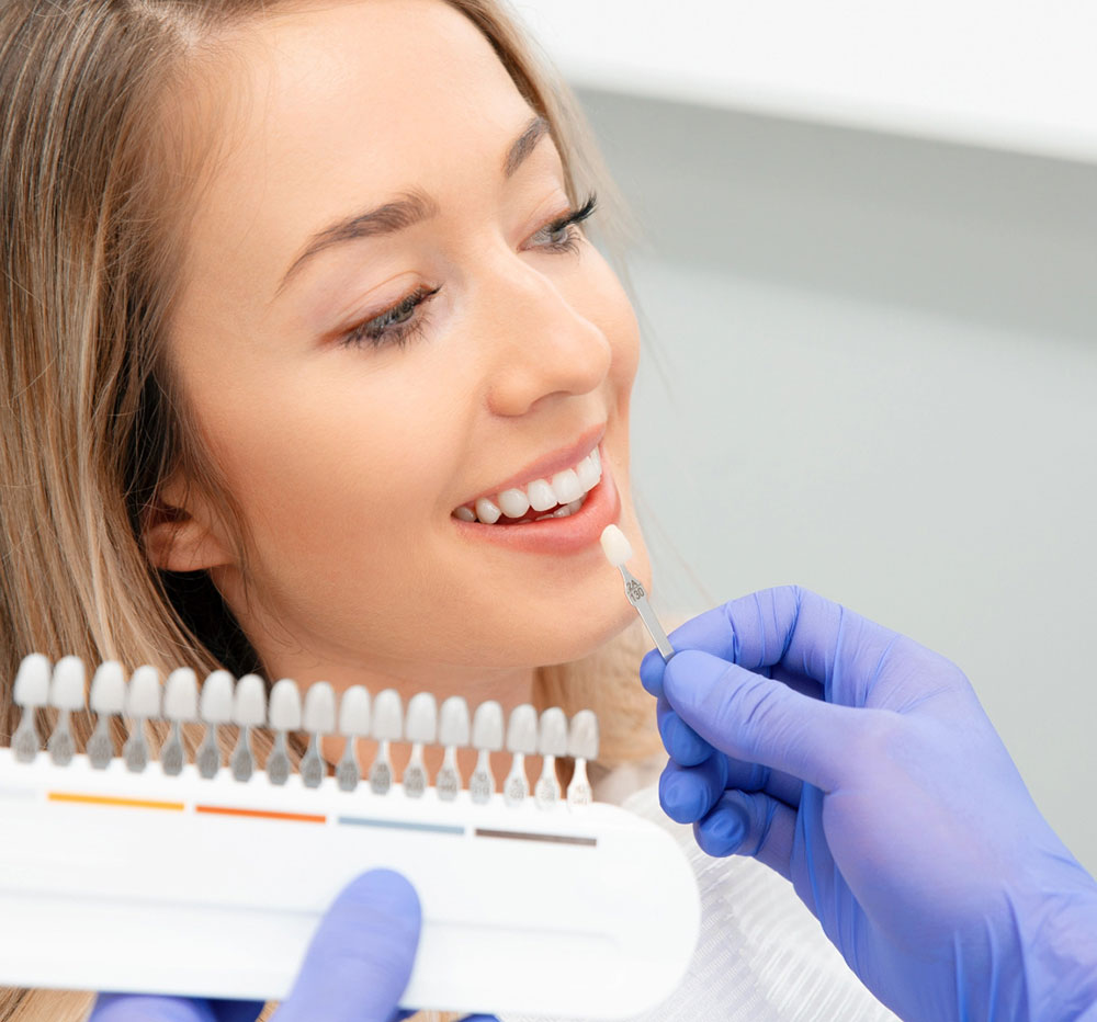 veneers in dental clinic kitsilano