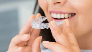 Invisalign